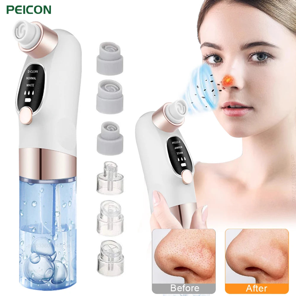 Pore Vacuum Blackhead Remover — Rechargeable Facial Pore Cleaner