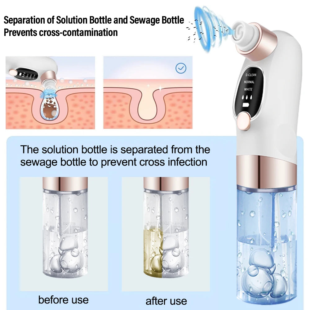 Pore Vacuum Blackhead Remover — Rechargeable Facial Pore Cleaner