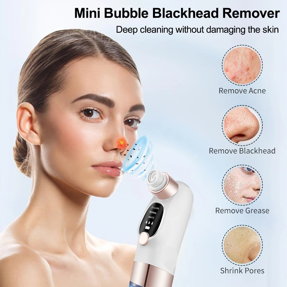 Pore Vacuum Blackhead Remover — Rechargeable Facial Pore Cleaner
