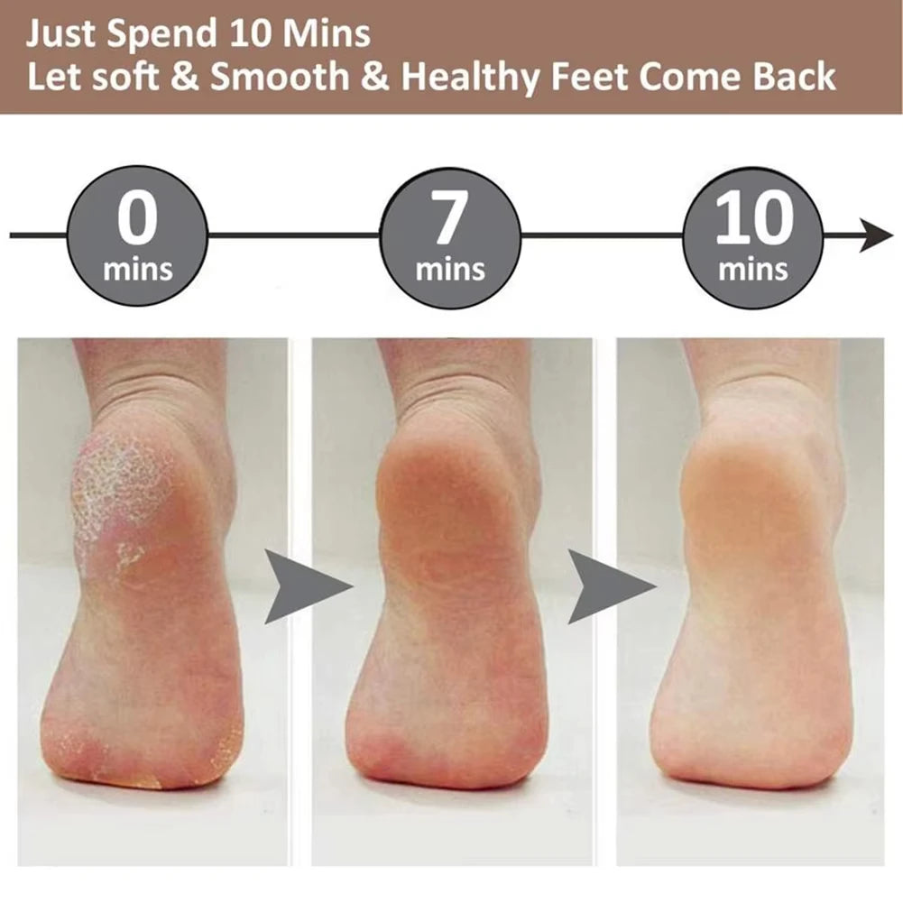 Electric Callus Remover — Rechargeable Foot Scrubber for Soft, Smooth Feet