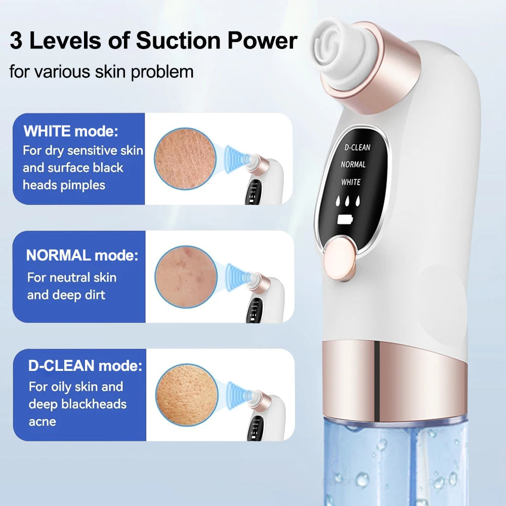 Pore Vacuum Blackhead Remover — Rechargeable Facial Pore Cleaner