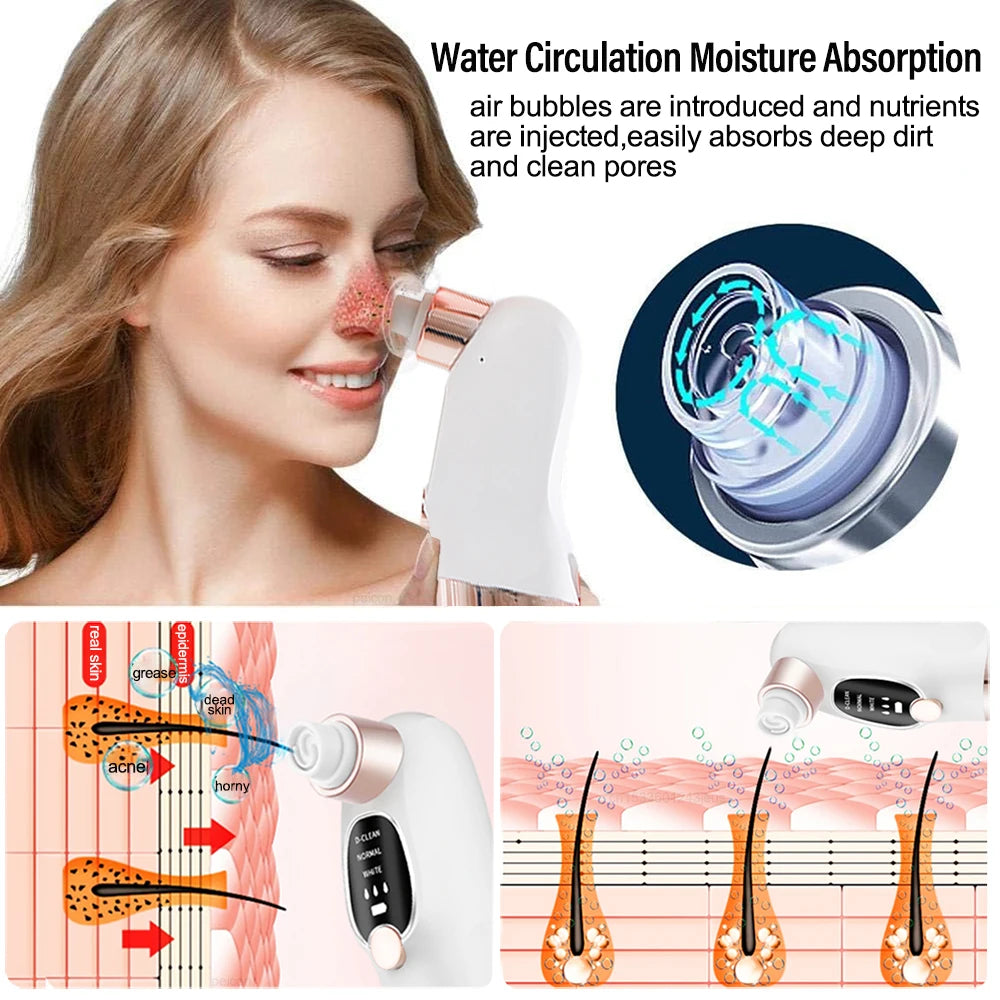 Pore Vacuum Blackhead Remover — Rechargeable Facial Pore Cleaner