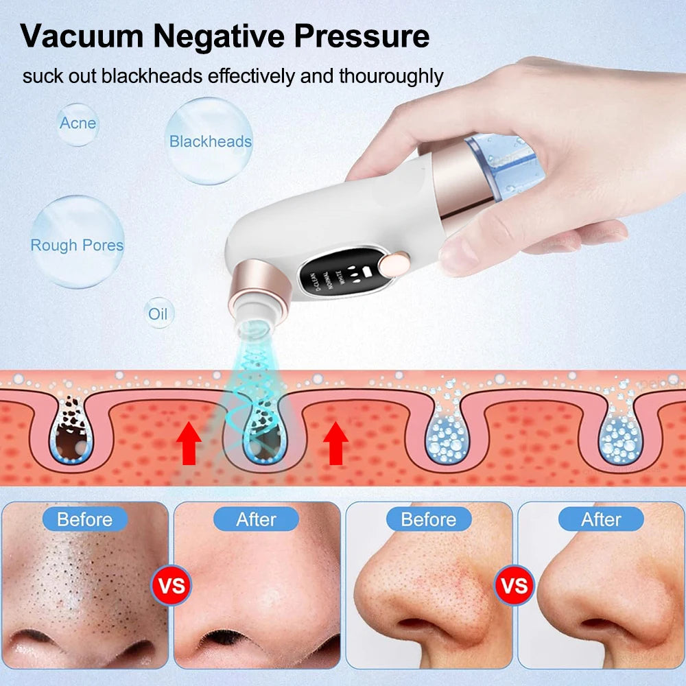 Pore Vacuum Blackhead Remover — Rechargeable Facial Pore Cleaner